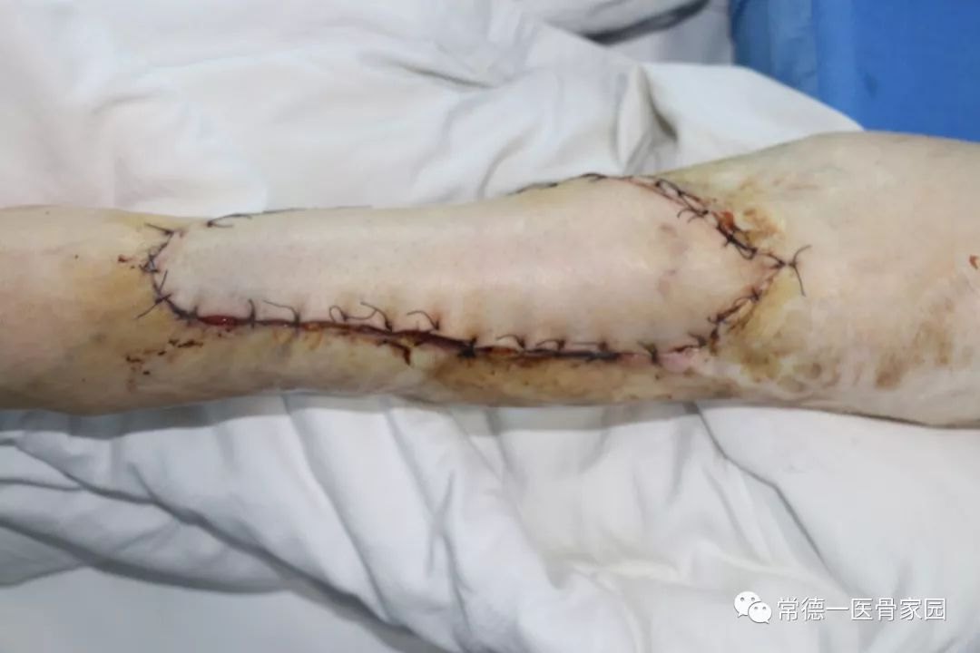 ayx官网_2018年我国121个城市空气质量达标(图1) 爱游戏(ayx)中国官方网站